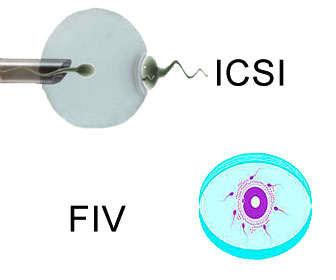 diferencia entre fecundacion in vitro y icsi