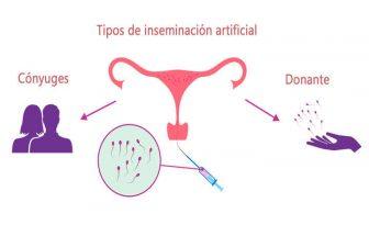 tipos inseminacion artificial