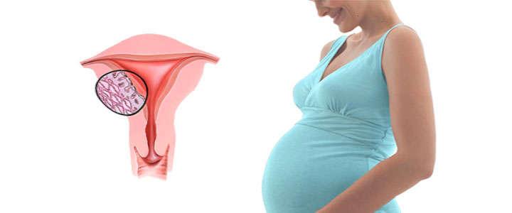 ovulos de progesterona en el embarazo
